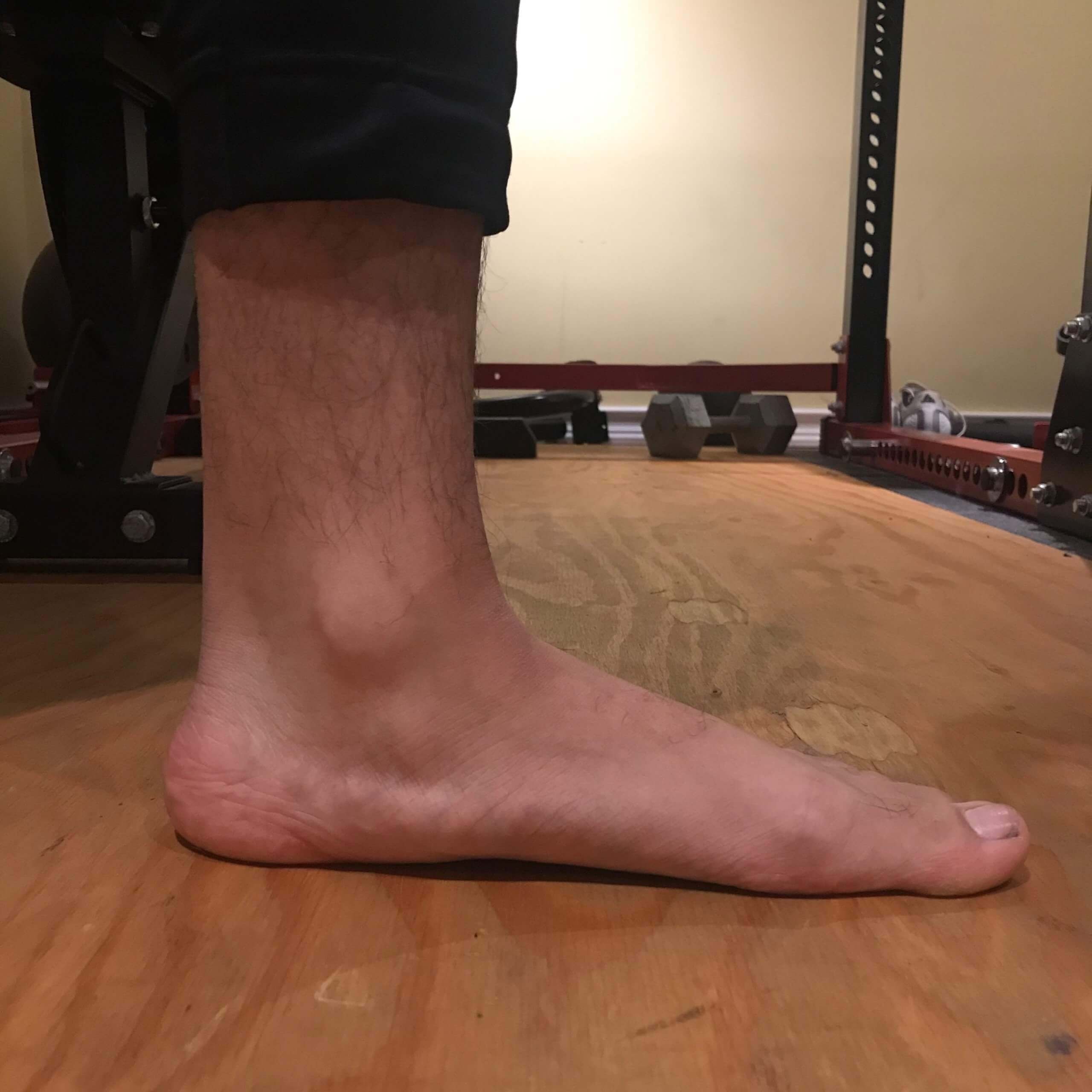 Activating the Foot before scaled